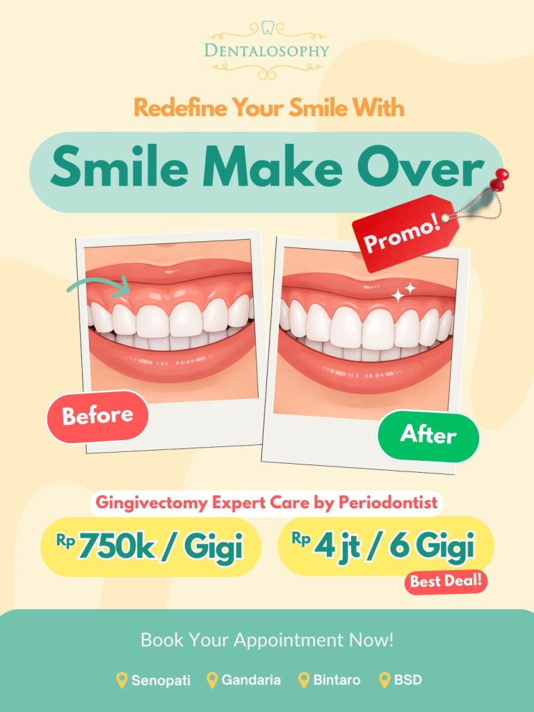 Harga promo gingivektomi